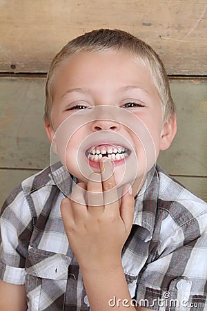 Missing tooth Stock Photo
