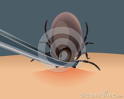 Mite parasites. Tick parasite removing by tweezers vector illustration. Mite parasites. Acarus. Mite spider. Mite Vector Illustration