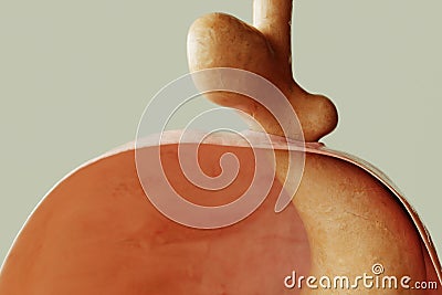 Mixed form of hiatus hernia type 3 - 3D rendering Stock Photo