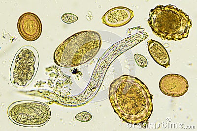 Mixed of helminths or parasitic worm in stool Stock Photo