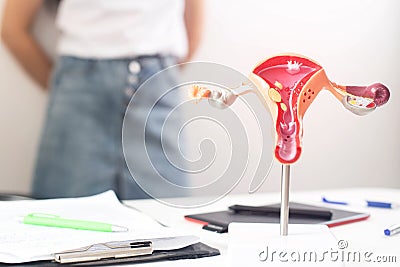 A model of the female reproductive system in the background is a girl in a doctor s office with irregular periods. The concept of Stock Photo
