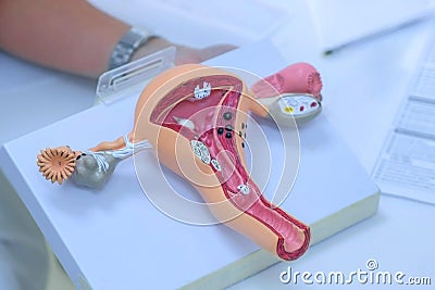 Model of female reproductive system. Doctor explains patient structure of organ. Stock Photo