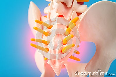 Model of the human spine, section of the inflamed coccyx with nerves on a blue background. Pinched nerve due to problems Stock Photo