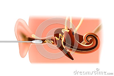 Model of the inner ear. Cleaning the auditory canal with a cotton swab. Vector Illustration