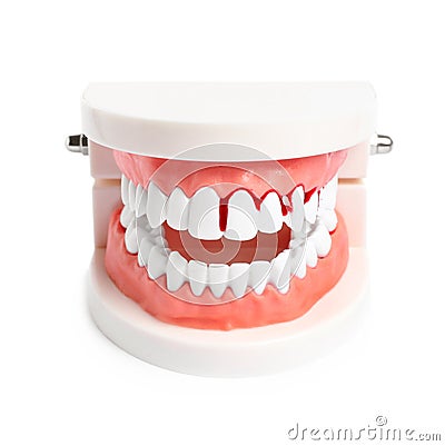 Model of jaw with blood on teeth against white background. Gum problems Stock Photo