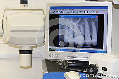 Modern dental x-ray Stock Photo