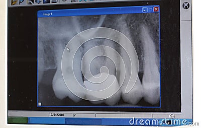 Modern dental x-ray Stock Photo