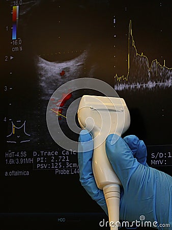 Modern linear ultrasound diagnostic probe held in doctor left hand in blue glove with doppler ocular ultrasound scan Stock Photo