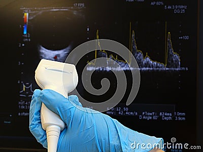 Modern linear ultrasound diagnostic probe held in doctor left hand in blue glove with doppler ocular ultrasound scan Stock Photo