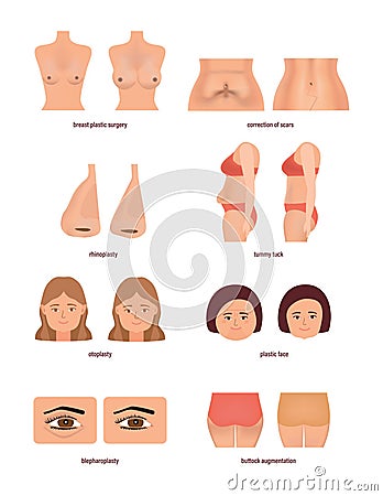 Modern medicine and healthcare concept. Different types of plastic surgery. Vector Illustration