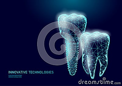 Molar tooth dental implant 3d low poly geometric model. Dentistry innovation future technology titan metal thread Vector Illustration