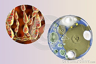 Mold Alternaria alternata, illustration and photo of colony on nutrient medium Cartoon Illustration