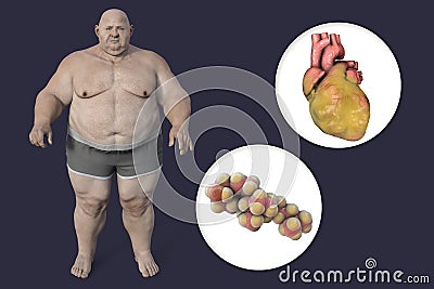 Molecule of cholesterol and obese heart in overweight man, 3D illustration. Concept of obesity and inner organs disease due to Cartoon Illustration