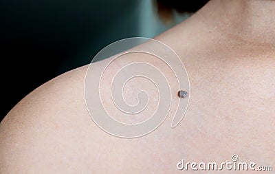 Moles Stock Photo