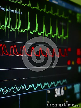 Monitor in the ICU. Stock Photo