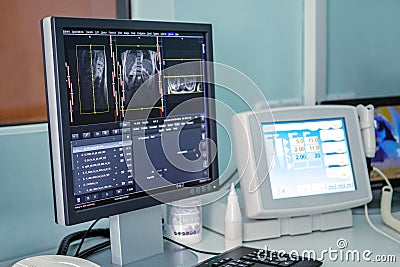 The monitor shows the results of a lung scan. MRI or CT scan Editorial Stock Photo
