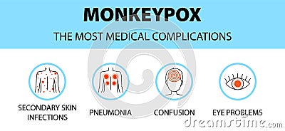 Monkeypox virus icons infographic. The most medical complications. New outbreak cases in Europe and USA Vector Illustration