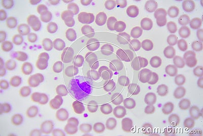 Monocyte cell Stock Photo