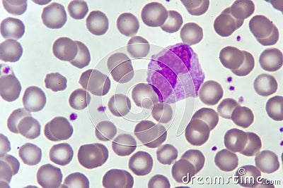 Monocyte cell in blood smear Stock Photo