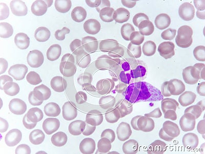 Monocyte and neutrophil cell in blood smear Stock Photo