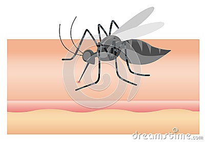 Mosquito sucking blood through human skin icon. Symptoms of dengue fever, Sika virus Stock Photo