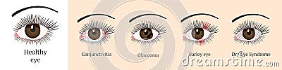 Most common eye problems. Vector Illustration