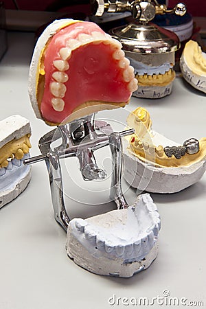 Mouth support device for wax teeth model Stock Photo