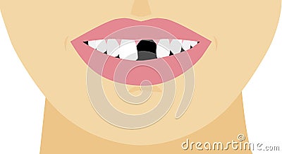 Mouth broken one toothless, illustration close-up Cartoon Illustration