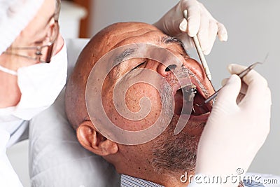 Mouth checkup Stock Photo