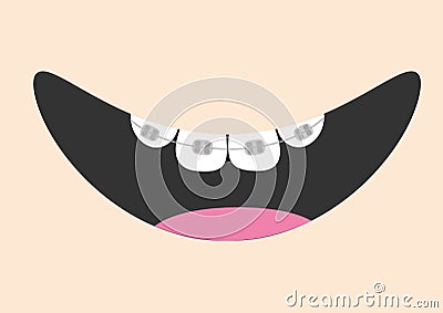 Mouth with tooth braces and tongue. Smiling face. Healthy teeth brace. Body part. Cute cartoon character. Oral dental hygiene Vector Illustration