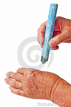 Moxibustion, chinese warming therapy Stock Photo