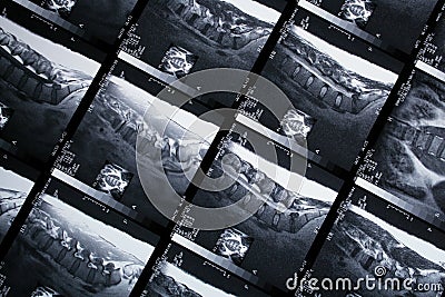 MRI Stock Photo
