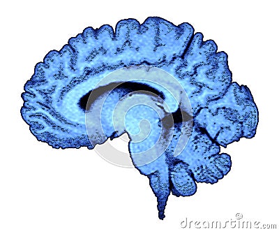 MRI Brain Scan Stock Photo