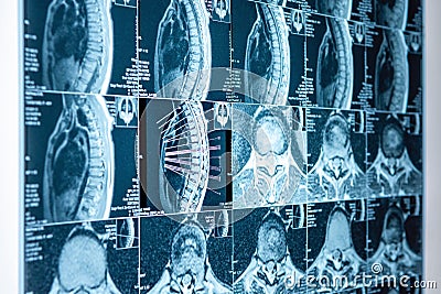 MRI scan of a healthy human brain, blurred focus Stock Photo