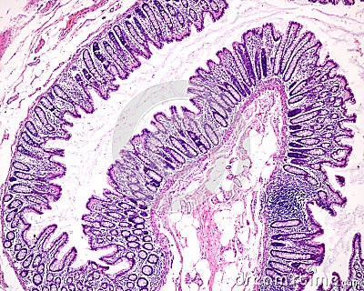 Mucosa of the human colon Stock Photo