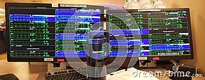 Multiple Green EKG Tracings on ICU Monitor Stock Photo
