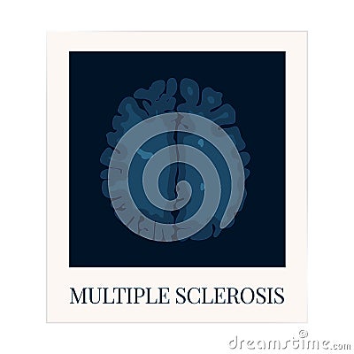 MRI scan of the brain affected by multiple sclerosis Vector Illustration