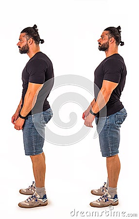 Muscular man with stooped and straight back Stock Photo