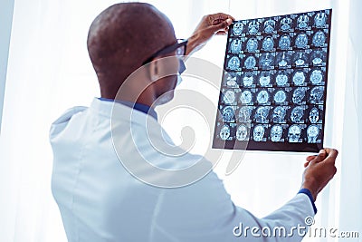 Smart nice doctor checking an X-ray image Stock Photo