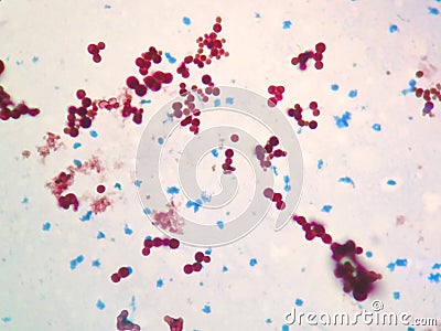 Mycobacterium Stock Photo
