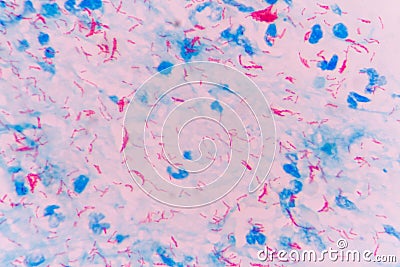 Mycobacterium tuberculosis Stock Photo