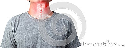 Neck bone cervical spondylosis inflammation the cervical spine Stock Photo