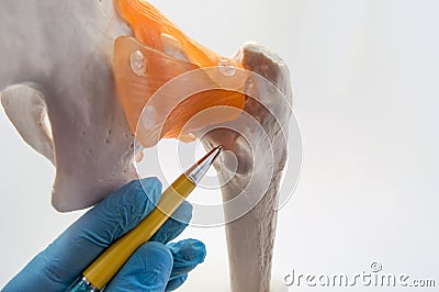 Neck of femur hip - a place of frequent fracture of femur concept photo. Doctor of orthopedic surgery indicates on neck of femur Stock Photo