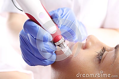 Needle mesotherapy Stock Photo