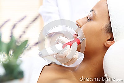 Needle Mesotherapy, Stock Photo