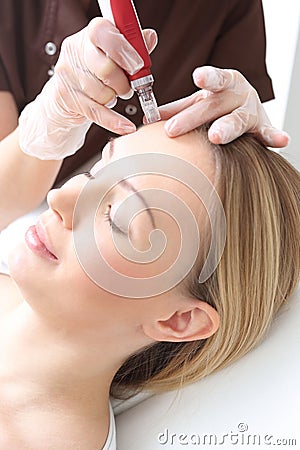 Needle mesotherapy, Stock Photo