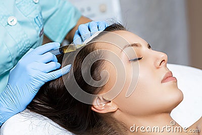 Needle mesotherapy. Cosmetic been injected in woman`s head. Thrust to strengthen hair and their growth Stock Photo