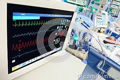 Neonatal ICU with ECG monitor Stock Photo