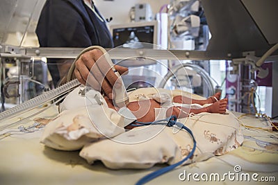 Neonatal Intensive Care Editorial Stock Photo