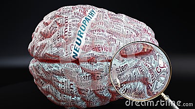 Neuropathy in human brain Stock Photo
